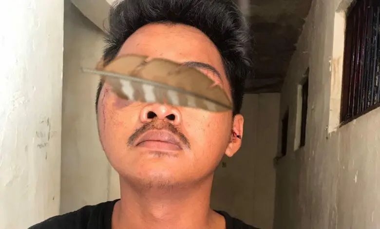 Pemuda di Makassar Dihakimi Massa Saat Curi Motor Pemuda di Makassar Dihakimi Massa Saat Curi Motor