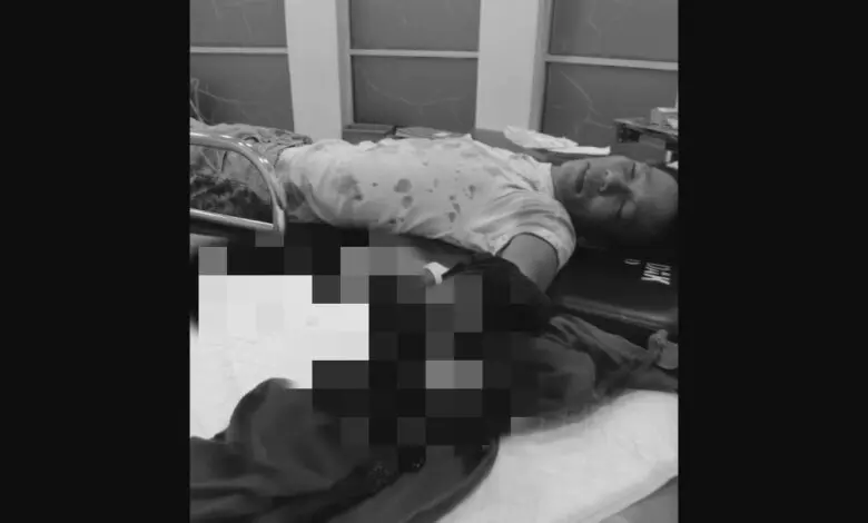 Tangan Pria di Luwu Hancur Karena Ledakan Kembang Api Kadaluwarsa Tangan Pria di Luwu Hancur Karena Ledakan Kembang Api Kadaluwarsa