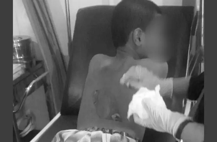 Guru yang Setrika Punggung Santrinya Hingga Melepuh Jadi Tersangka Guru yang Setrika Punggung Santrinya Hingga Melepuh Jadi Tersangka