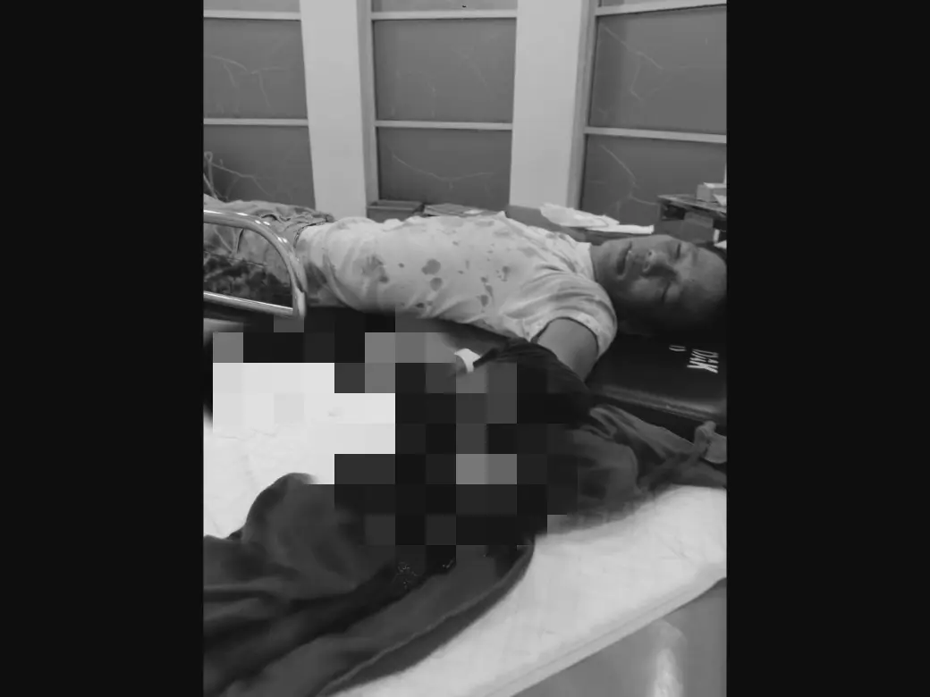 Tangan Pria di Luwu Hancur Karena Ledakan Kembang Api Kadaluwarsa